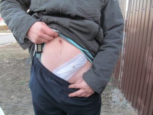 Какая статья за ножевое ранение в живот