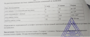 Плоскостопие 2 группа здоровья ввк