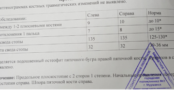 Плоскостопие 2 группа здоровья ввк
